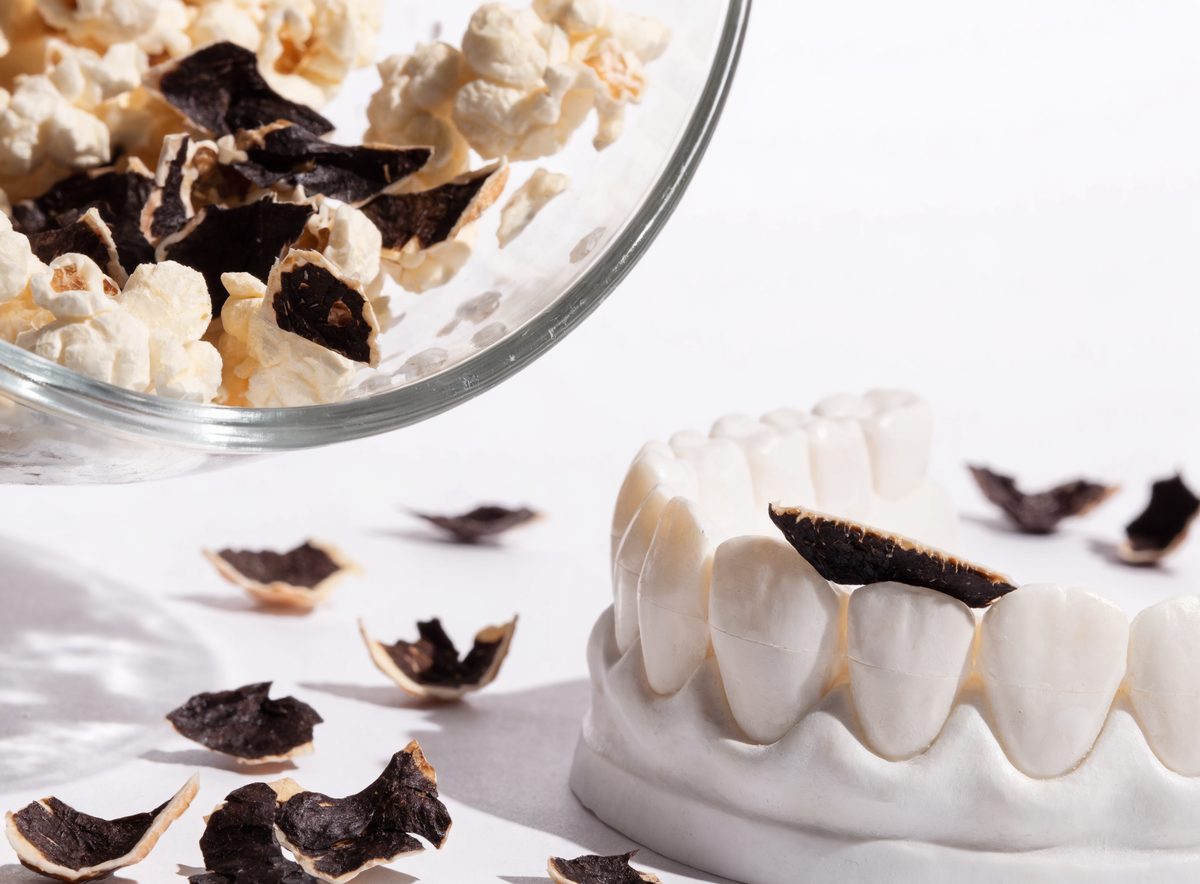 Dental model jaw with popcorn hull fragments stuck between teeth, surrounded by scattered hulls